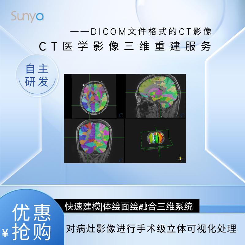 CT医学影像三维重建服务